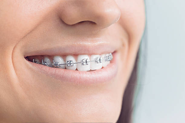 Best Full Mouth Reconstruction  in Holdrege, NE